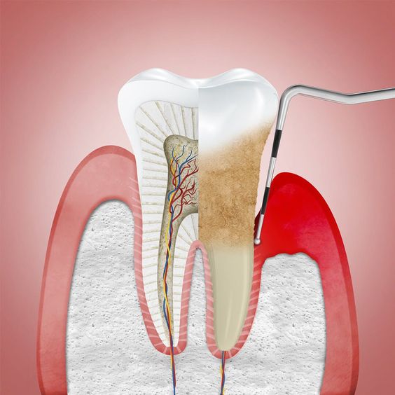 Kapsamlı Periodonta